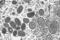 CDC microscopic image shows monkeypox virus particles