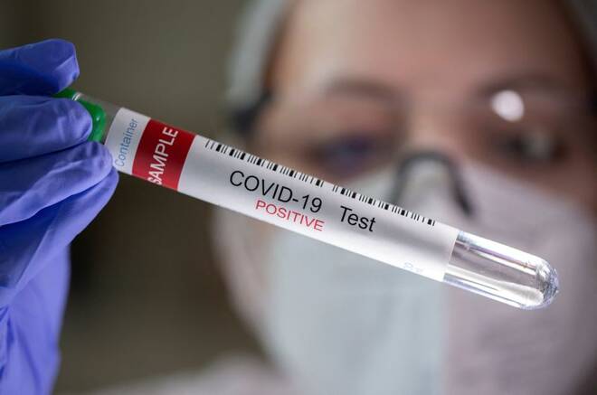 A test tube labelled "COVID-19 Test positive" is seen in this illustration picture