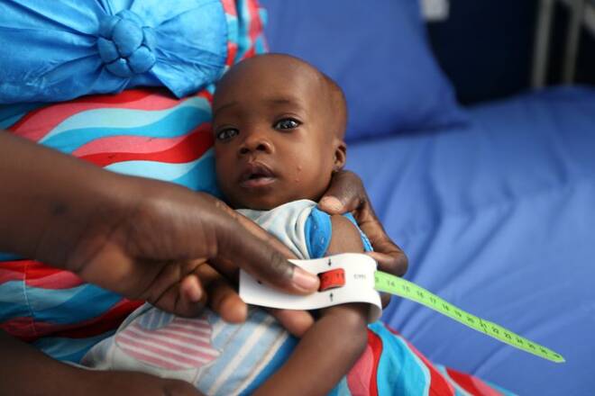 A muac tape used to screen malnutrition in children at the stabilisation ward in Molai General Hospital Maiduguri