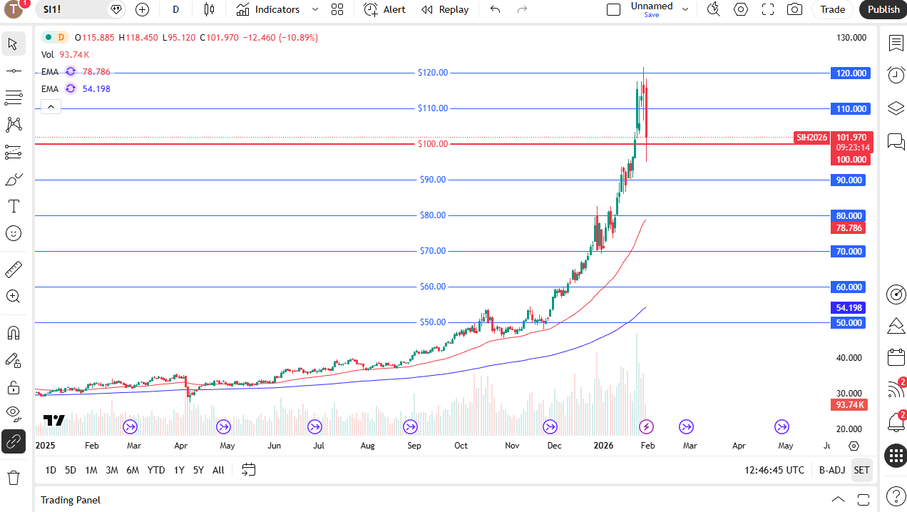 Silver daily chart.