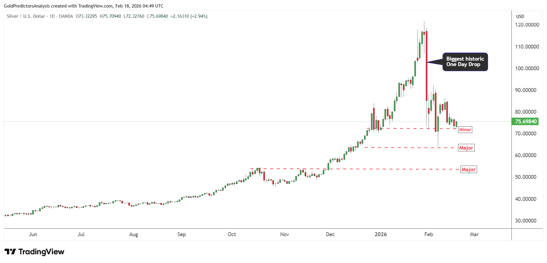 Silver Support Zones