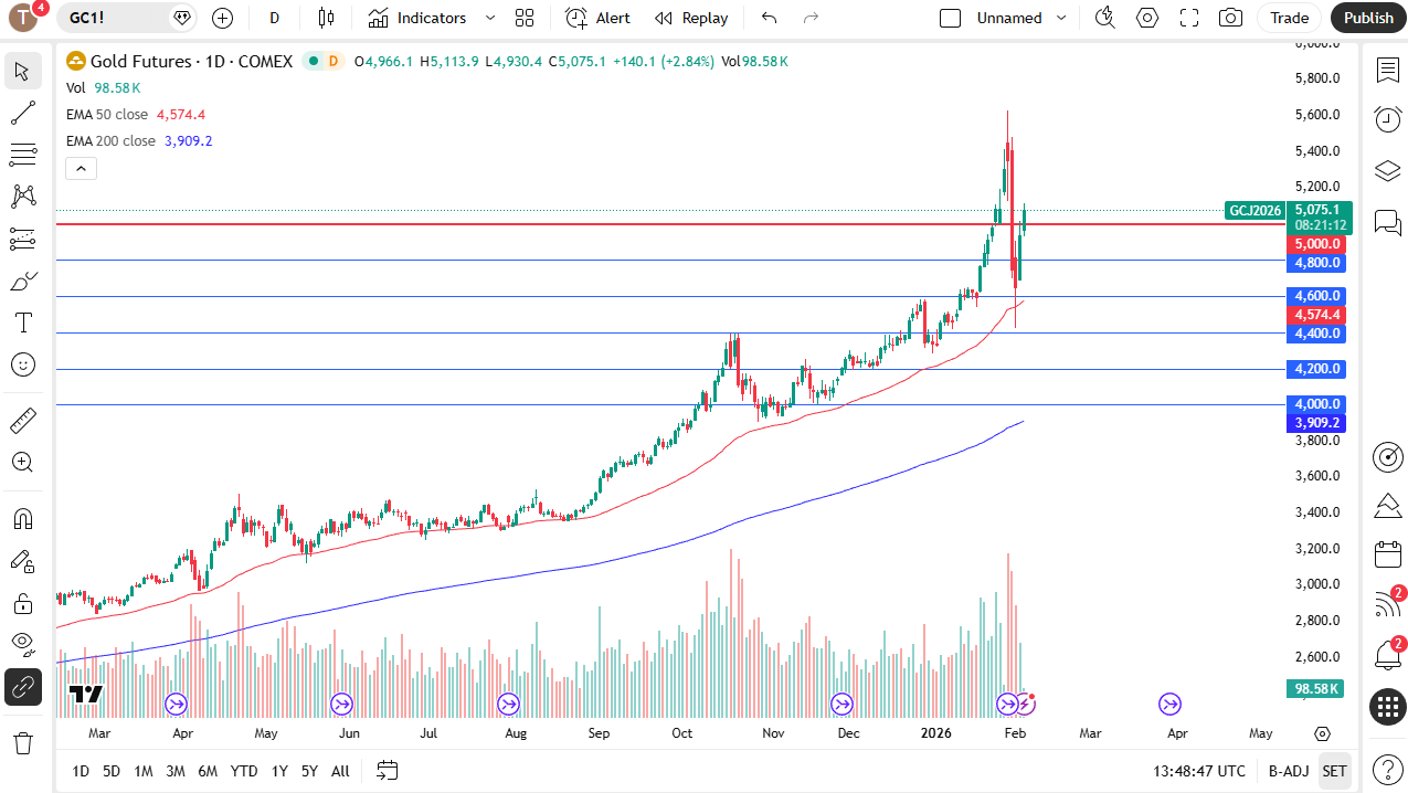 Gold daily candlestick chart. Source: TradingView.