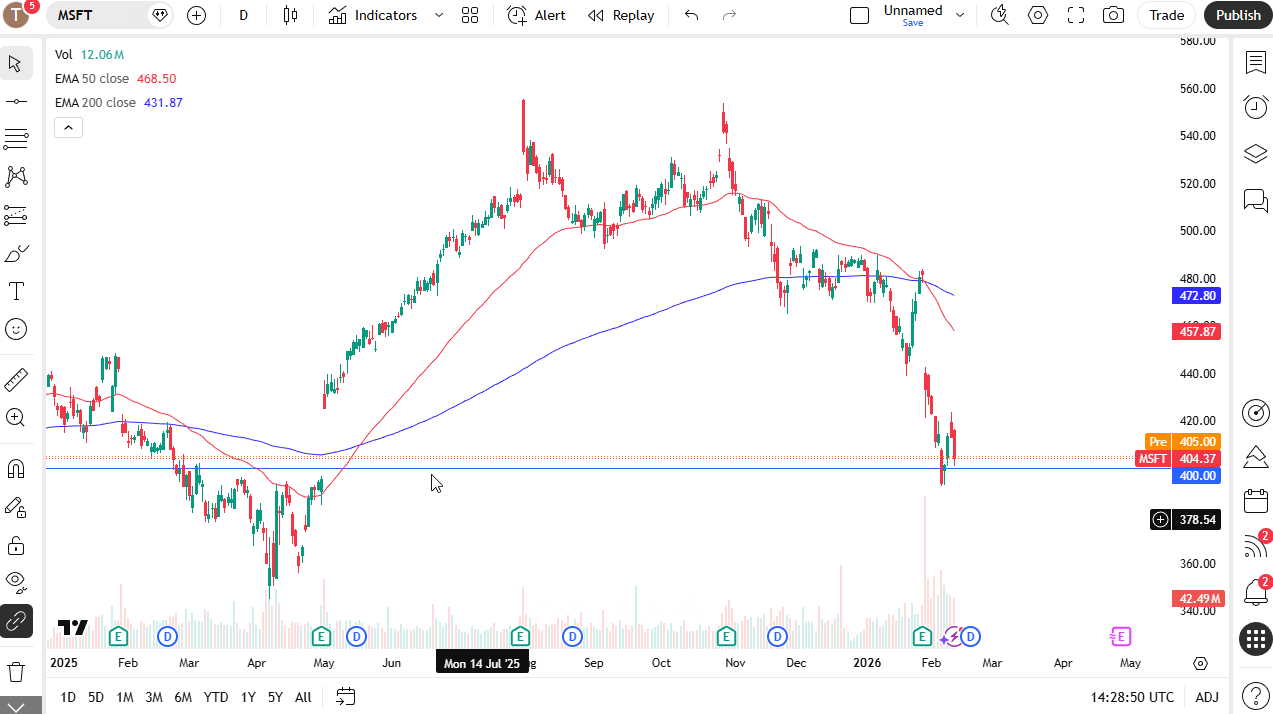 Microsoft daily candlestick chart.
