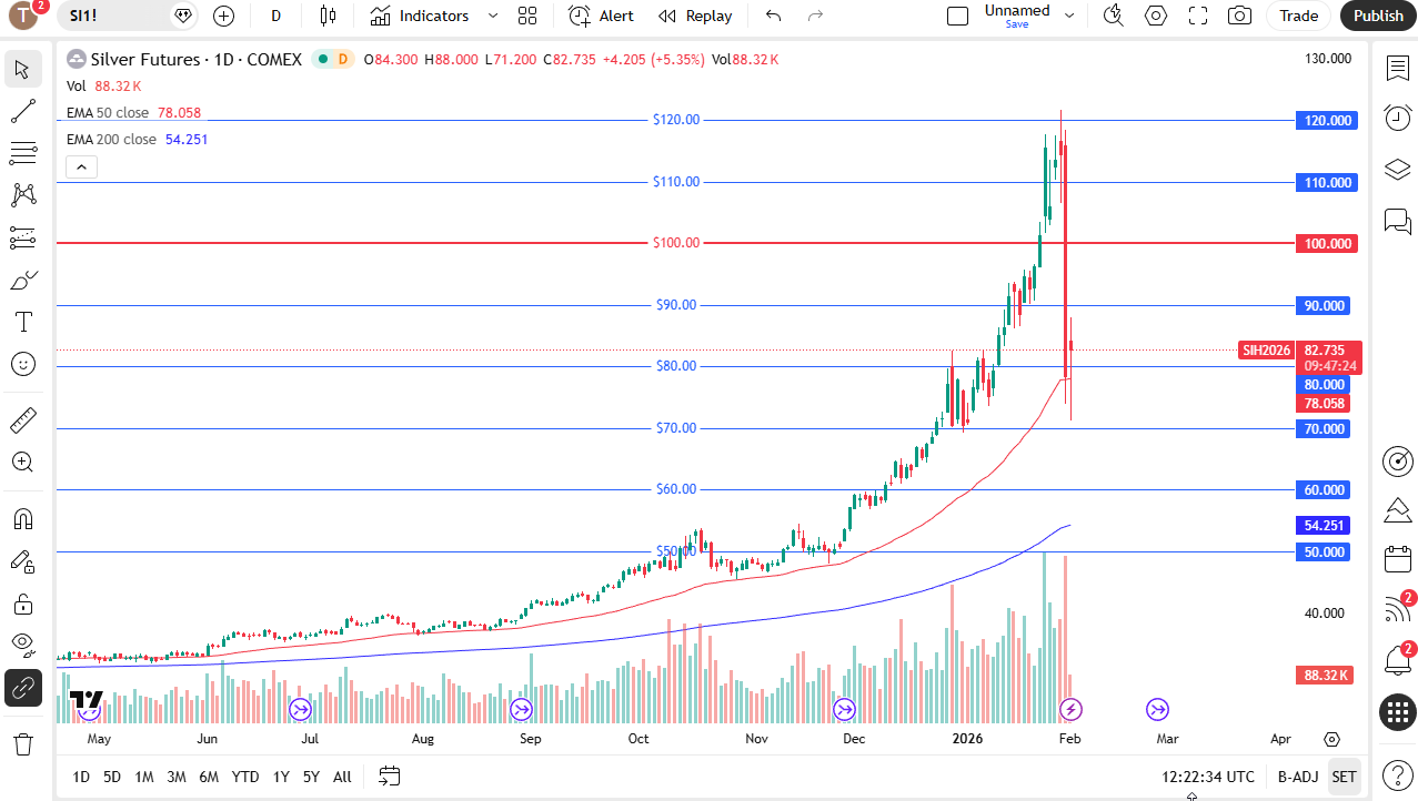 Silver daily chart. 