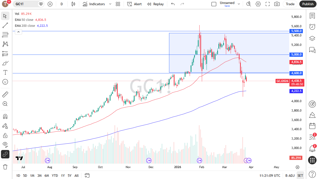 Gold daily candlestick chart. Source: TradingView