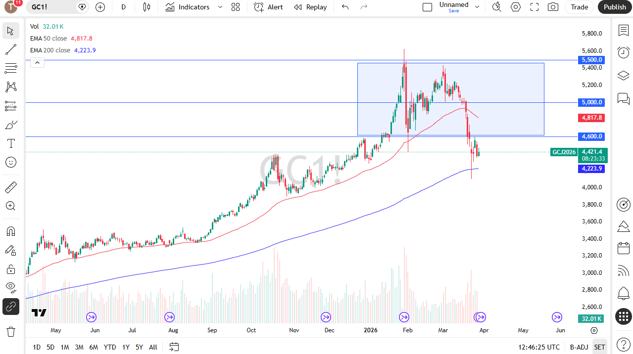 Gold daily candlestick chart. Source: TradingView