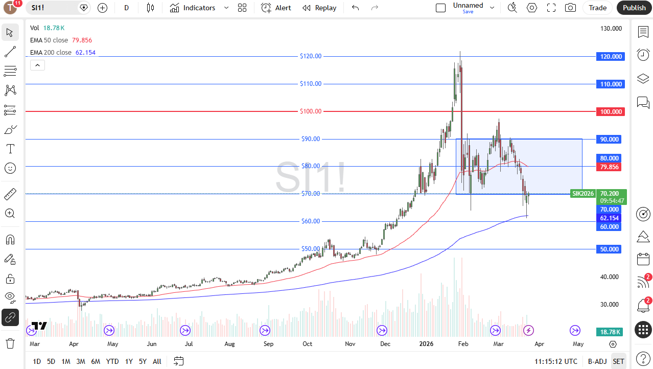 Silver daily candlestick chart. Source: TradingView