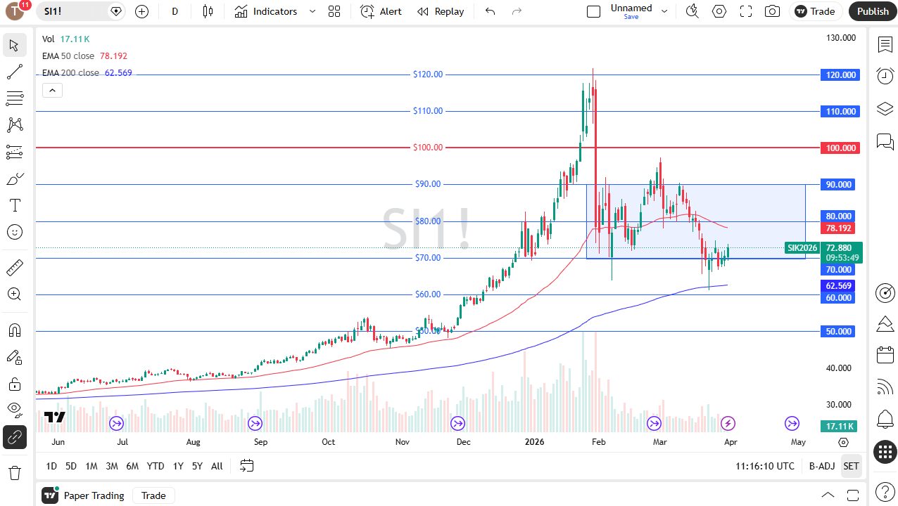 Silver daily candlestick chart. Source: TradingView