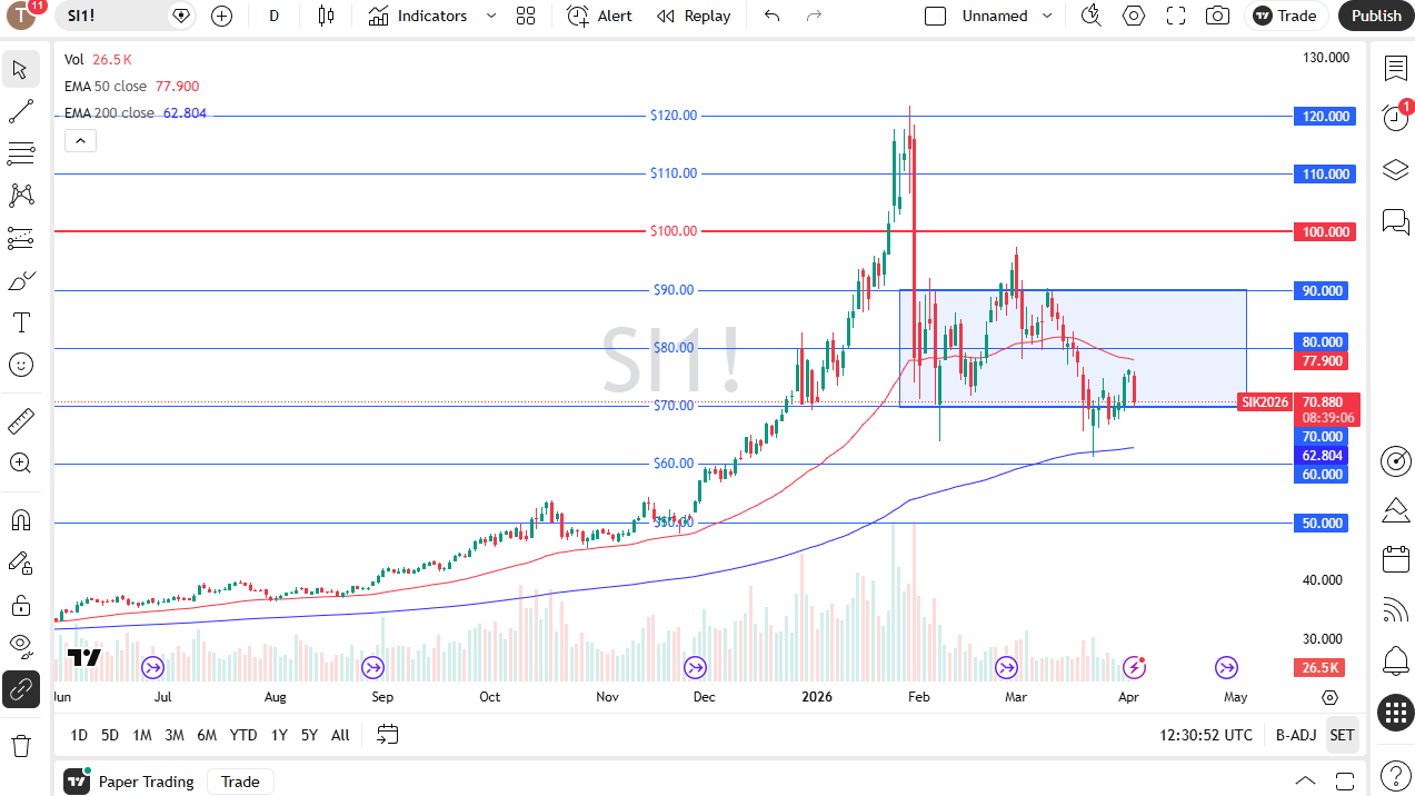 Silver daily candlestick chart. Source: TradingView