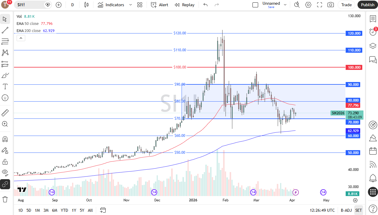 Silver daily chart. Source: TradingView
