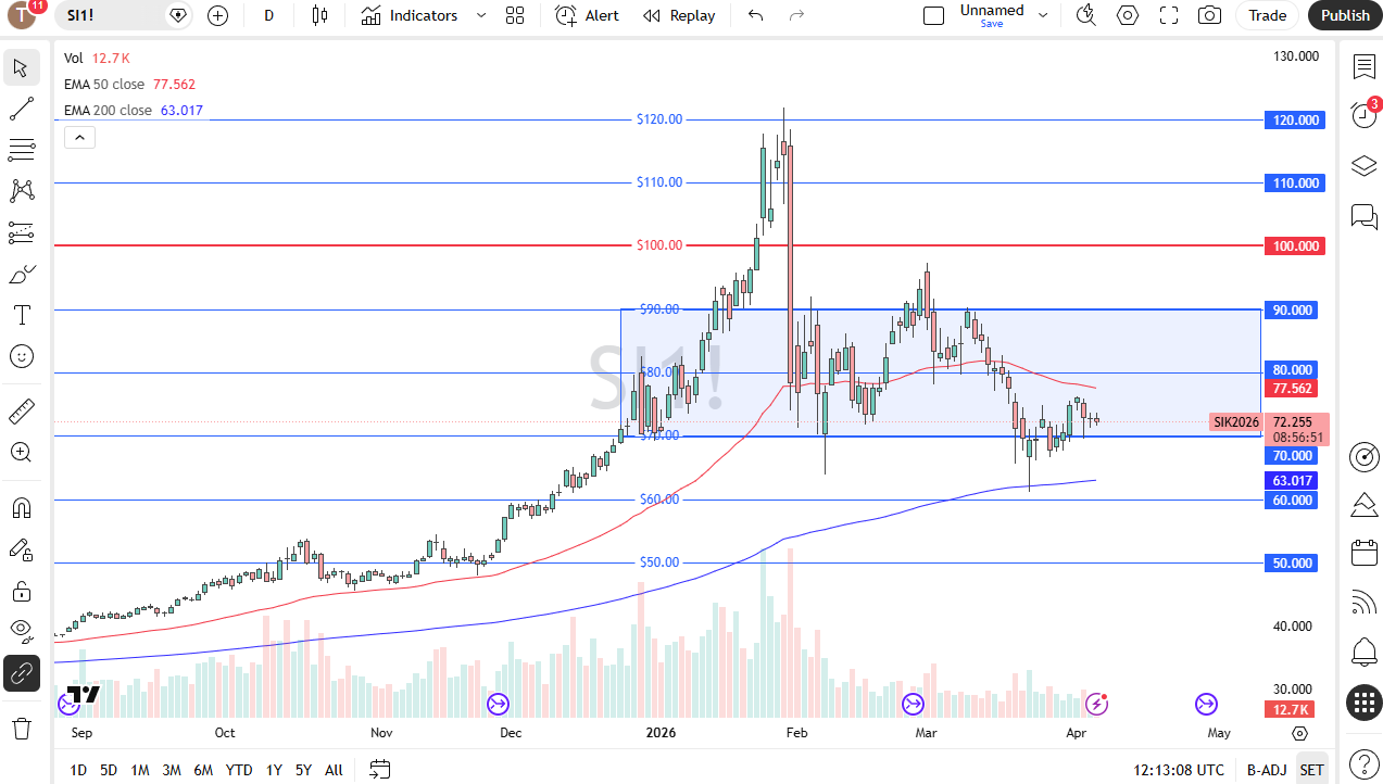 Silver daily chart. Source: TradingView