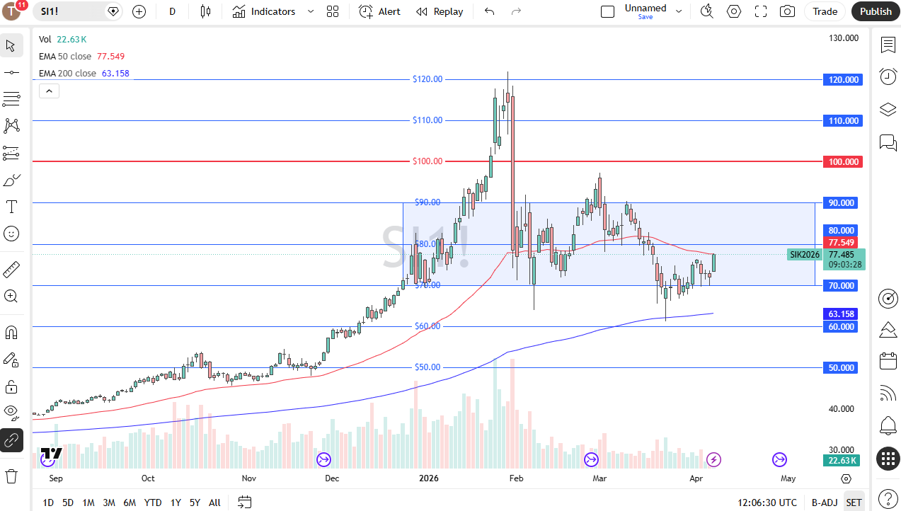 Silver daily chart. Source: TradingView