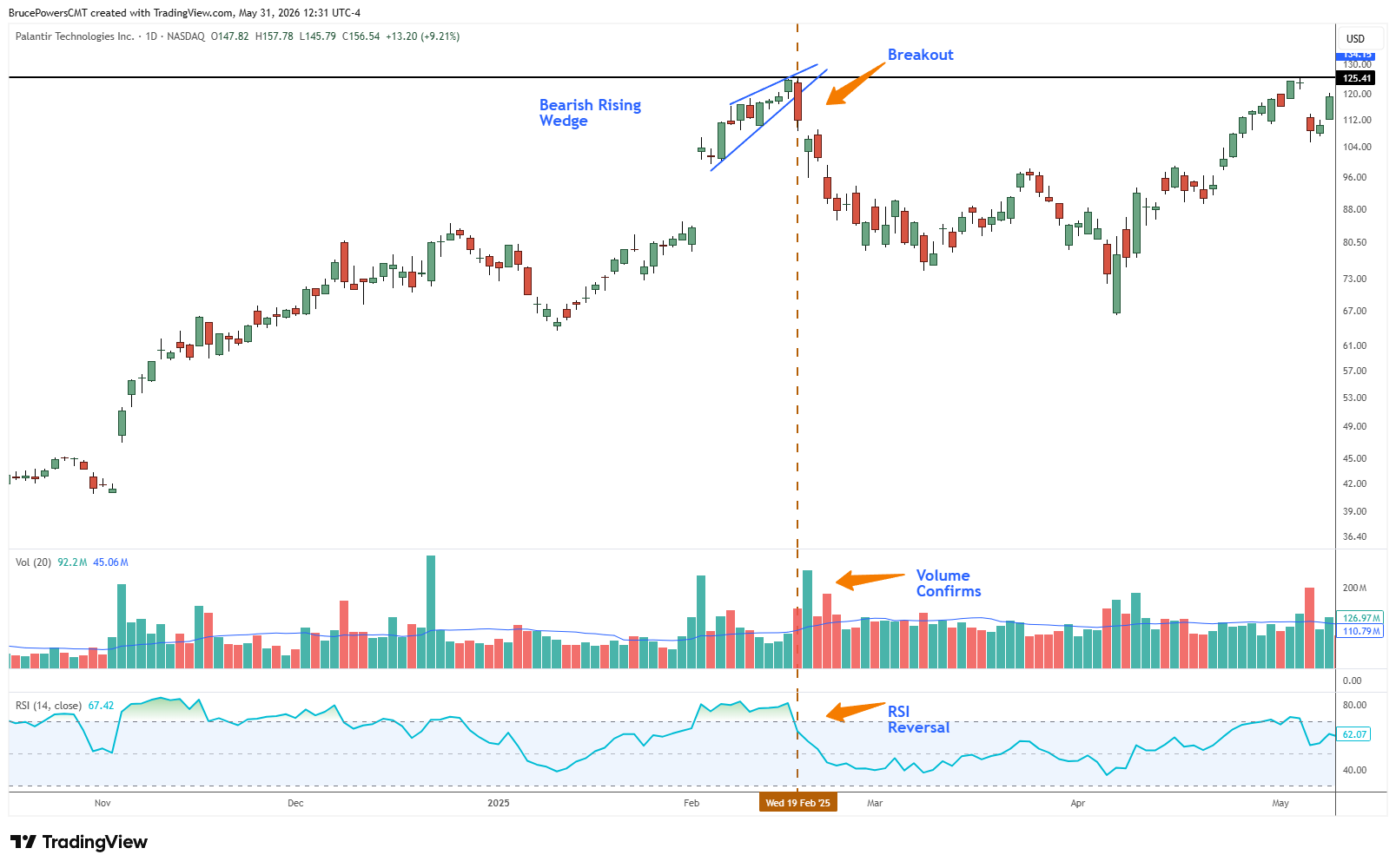Grafico giornaliero a candele di Palantir Technologies (PLTR) su NASDAQ con l'istogramma dei volumi e l'RSI(14) sotto, che mostra il prezzo rompere al ribasso da un rising bearish wedge a metà febbraio 2025 con volumi in espansione e RSI che scende sotto la linea mediana a 50 — tre segnali di conferma che precedettero un calo di circa il 40%.