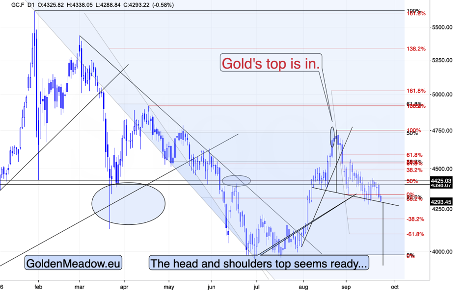 Gold at the Neckline as Yields Hit 2007 Highs - Image 2