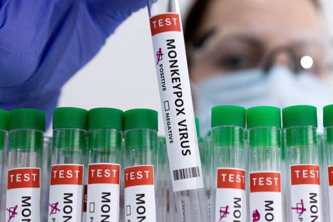 Tubos de prueba etiquetados como "virus de la viruela del mono positivo" se ven en esta ilustración